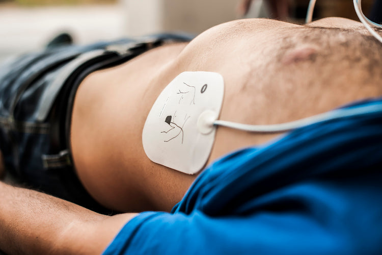 Buy Defibrillator Pads from Medisave