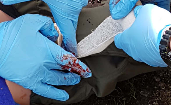 Buy Haemorrhage Control from Medisave