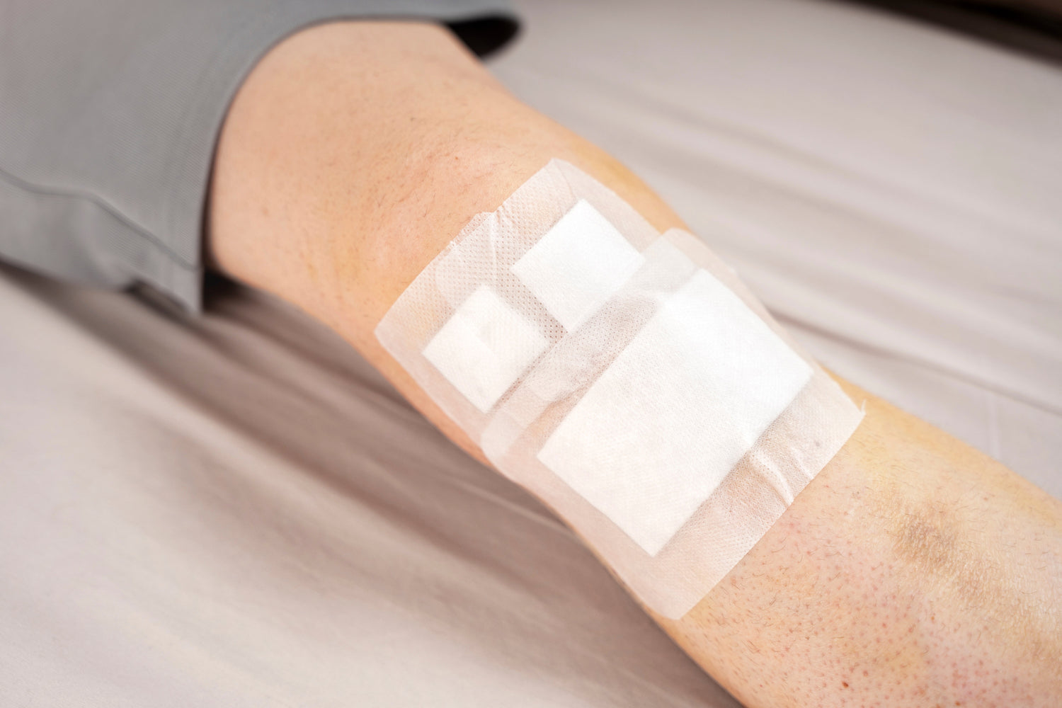 Other Foam Dressings