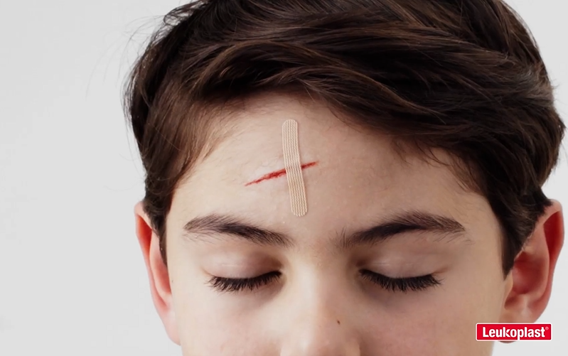 Leukosan Wound Closure Strips