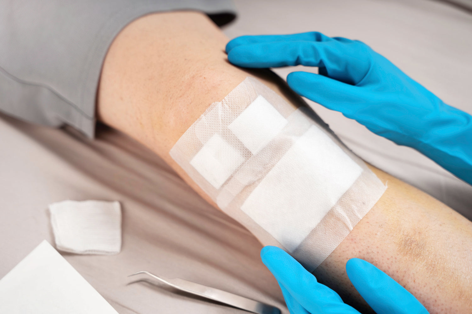 Wound Dressing Packs