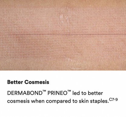 Dermabond AHV12 Topical Skin Adhesive 0.5ml - Box of 12