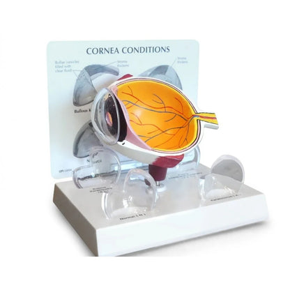 Eye Anatomy & Pathology Collection - 