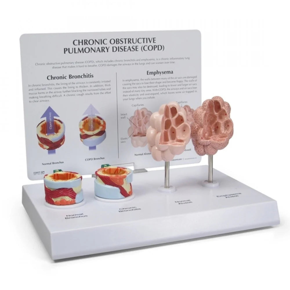 Lung Anatomy & Pathology Collection - 