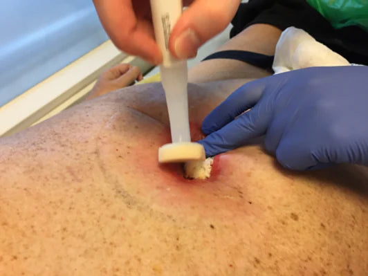 3M™ Cavilon™ Advanced Skin Protectant 0.7ml - Pack of 16 - 