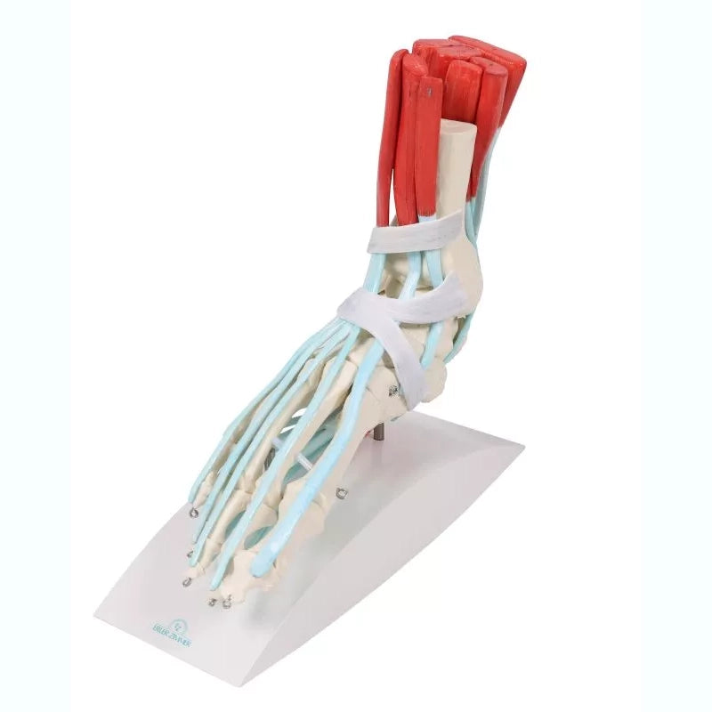 Skeleton of a Foot with Ligaments