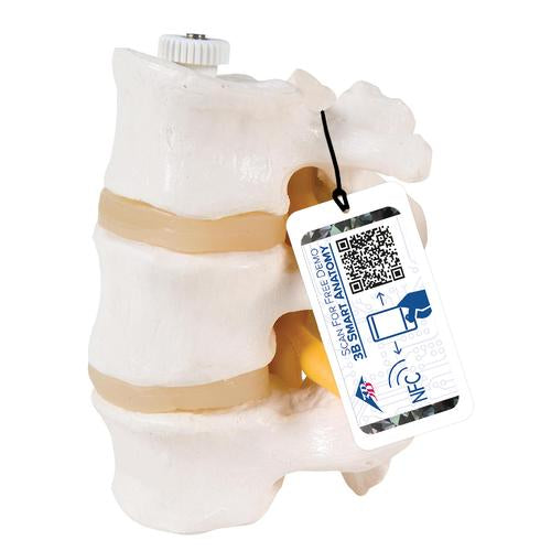 3 Human Lumbar Vertebrae, Flexibly Mounted - 