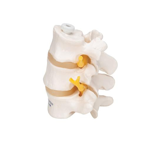 3 Human Lumbar Vertebrae, Flexibly Mounted - 