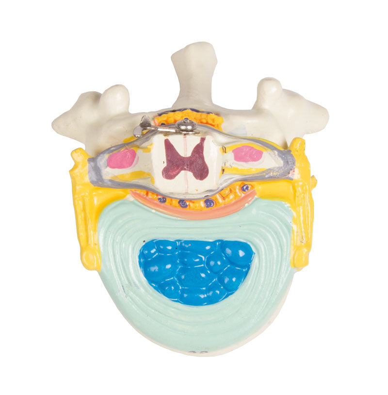 Human Torso Model with Back, 27 parts - CLEARANCE - 3B Scientific