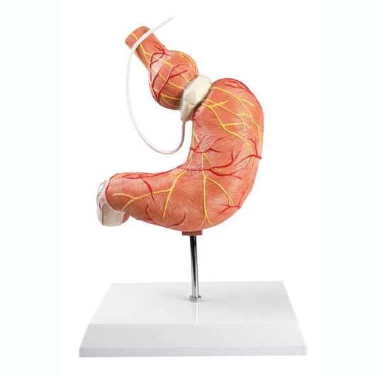 Stomach Model with Gastric Band - 