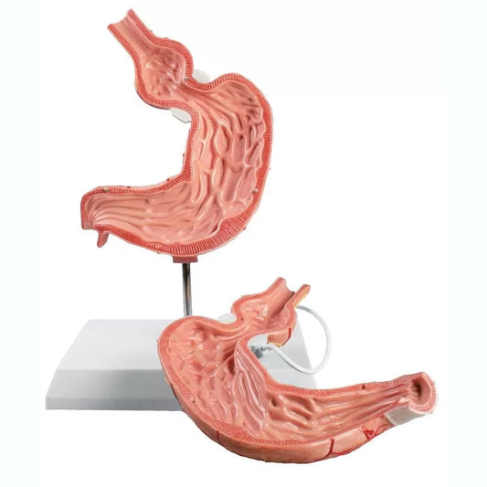 Stomach Model with Gastric Band - 