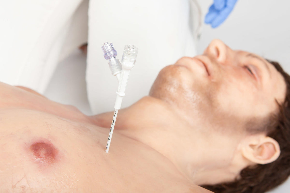 Needle Decomplression Russell PneumoFix®-8 Sterile Decompression Needle – Medisave UK