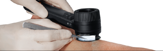 HEINE Distance Ring - Heine