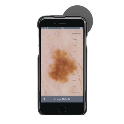 HEINE IC1 With Contact Plate & Scale, Mobile Phone Case IC1/6 - 