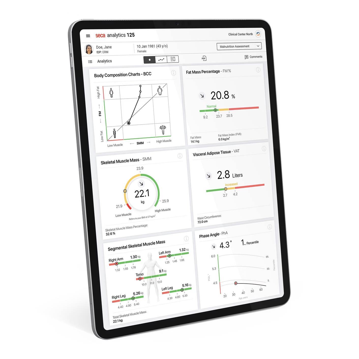 SECA mBCA Alpha Body Composition Analyser - 