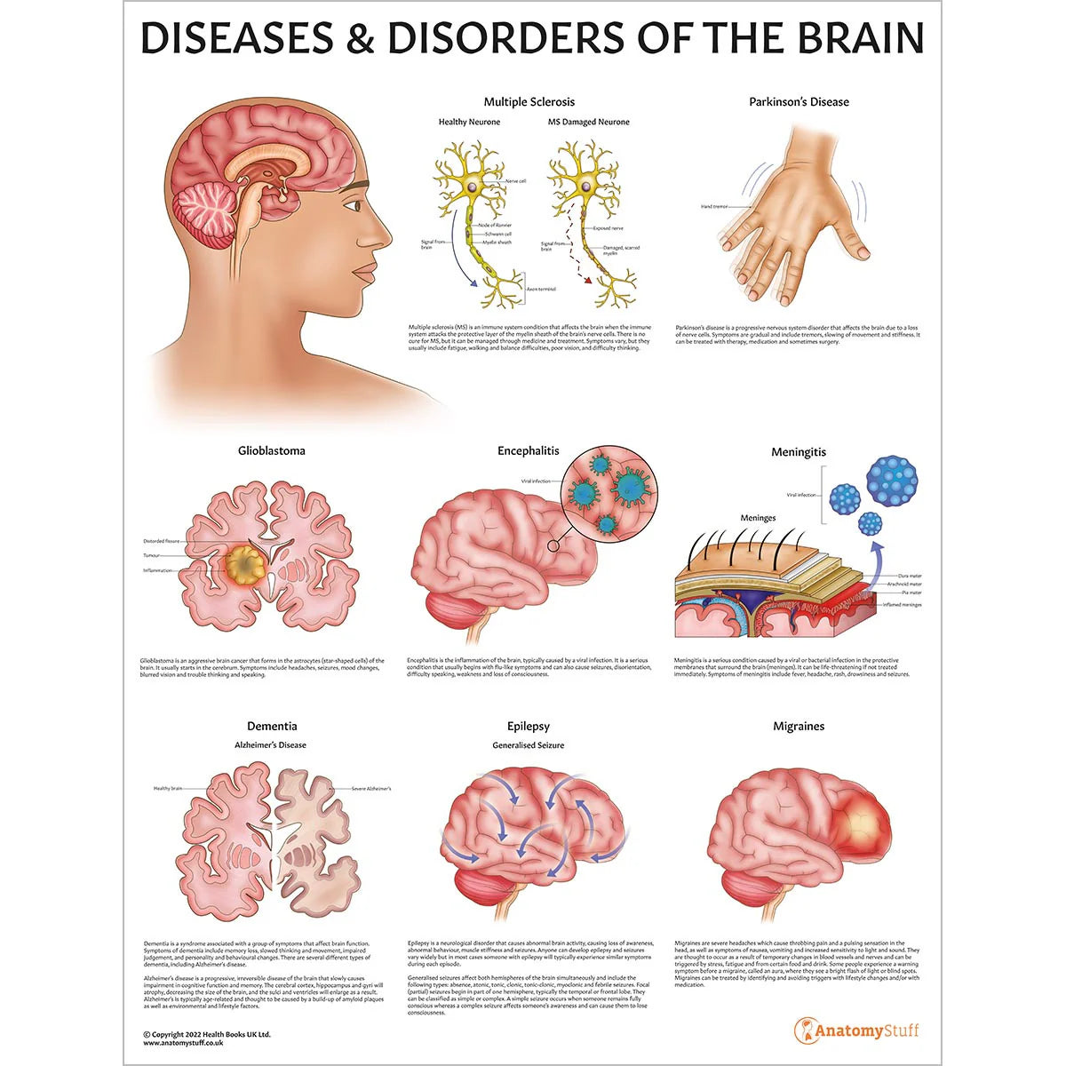 Brain Pathologies Brain Anatomy & Pathology Collection – Medisave UK