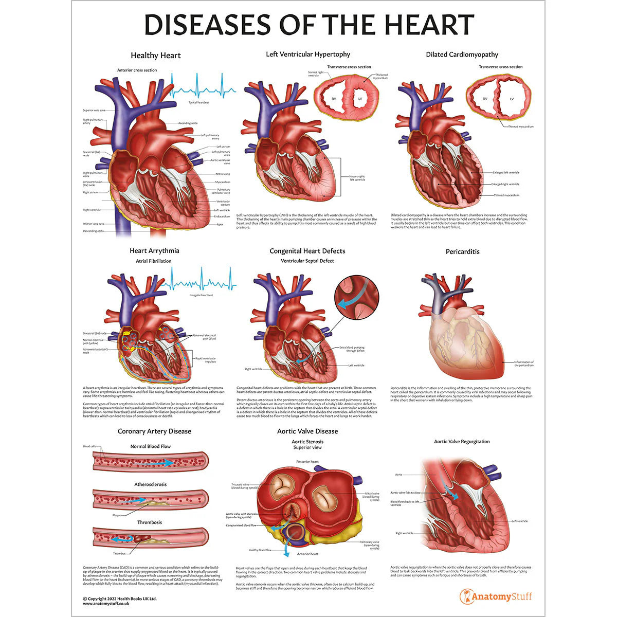 Heart Identiification Heart Anatomy & Pathology Collection – Medisave UK