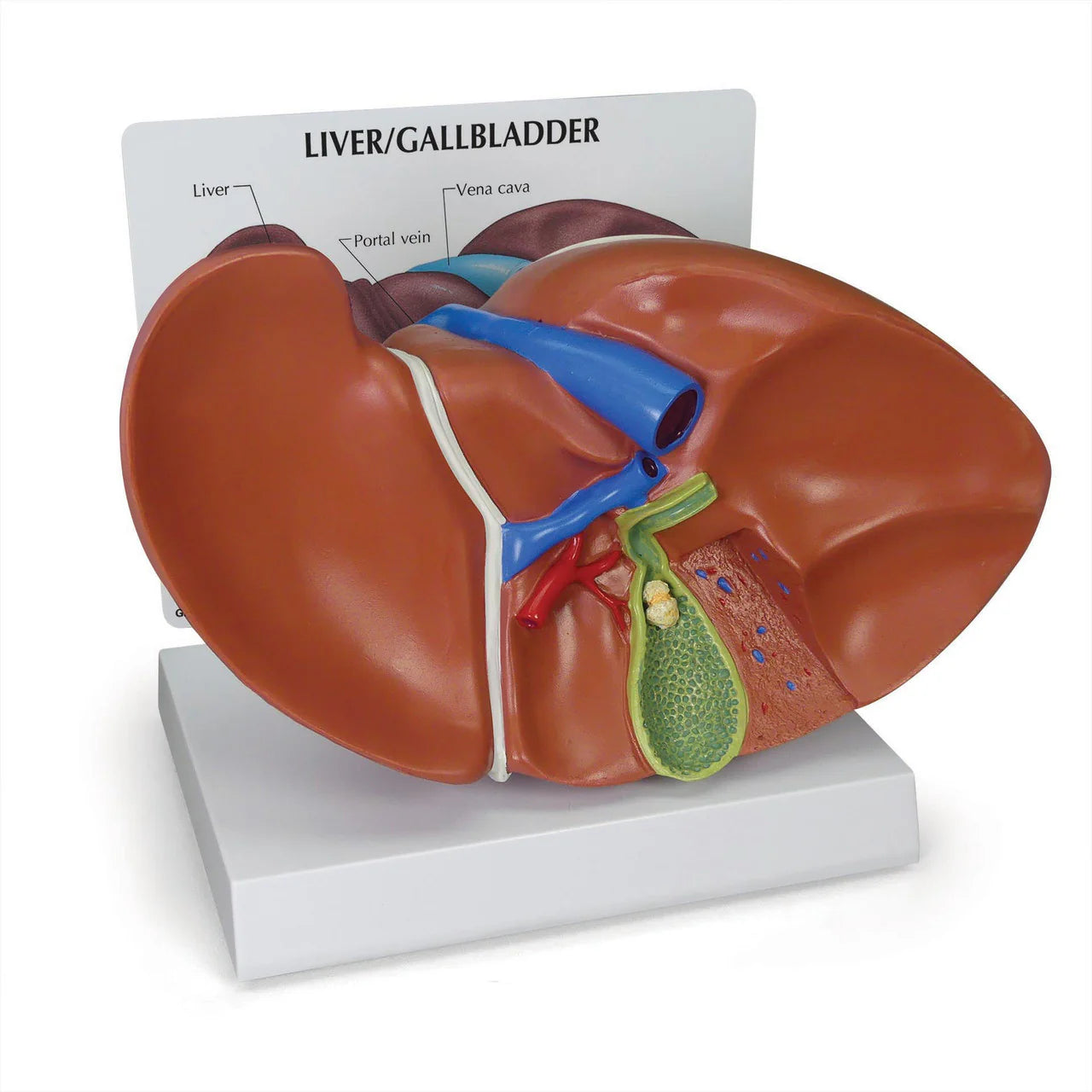 Liver Anatomy & Pathology Collection - 