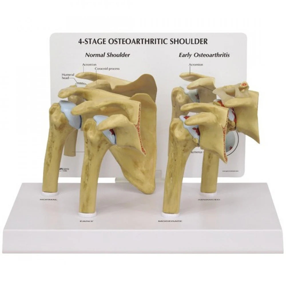 Shoulder Anatomy & Pathology Collection - 