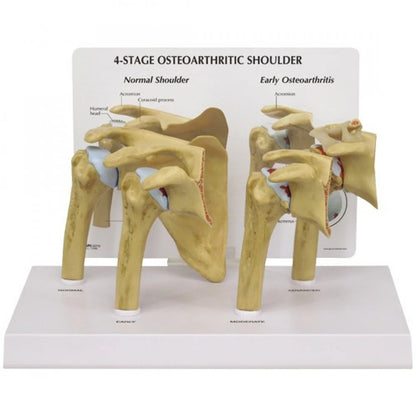 Shoulder Anatomy & Pathology Collection - 
