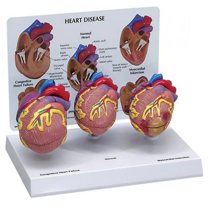 Heart Anatomy & Pathology Collection - 