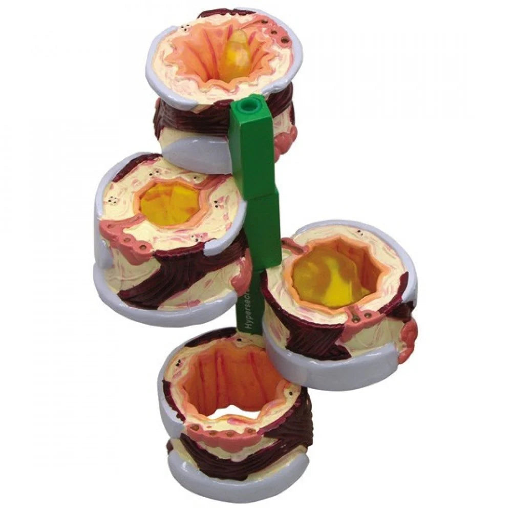 Lung Anatomy & Pathology Collection - 