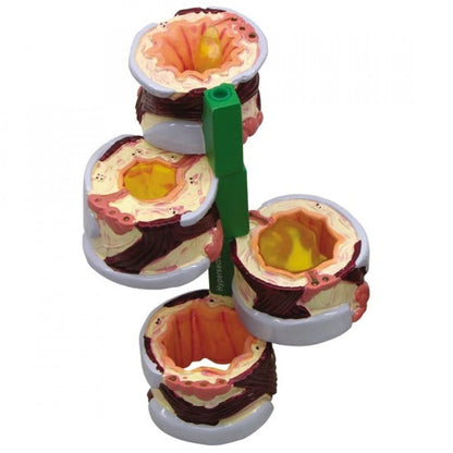 Lung Anatomy & Pathology Collection - 