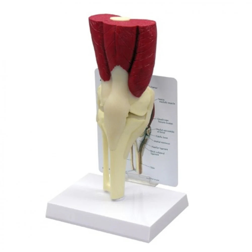 Knee Anatomy & Pathology Collection - 