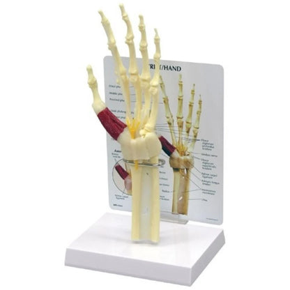 Hand & Wrist Anatomy & Pathology Collection - 