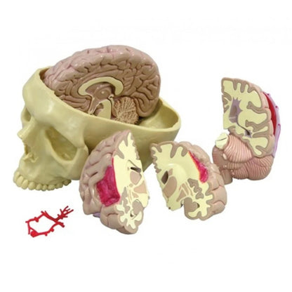 Brain Anatomy & Pathology Collection - 