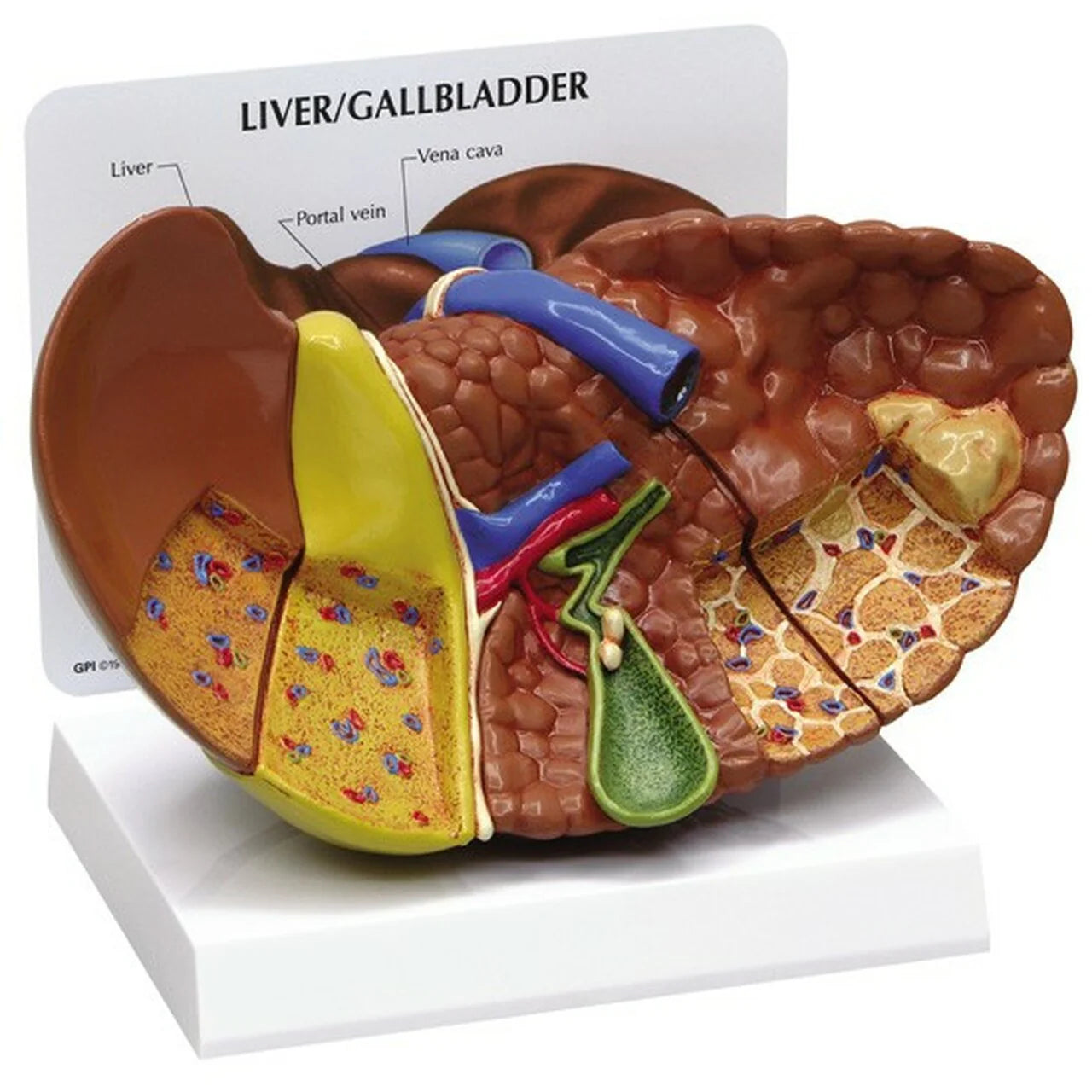 Liver Anatomy & Pathology Collection - 