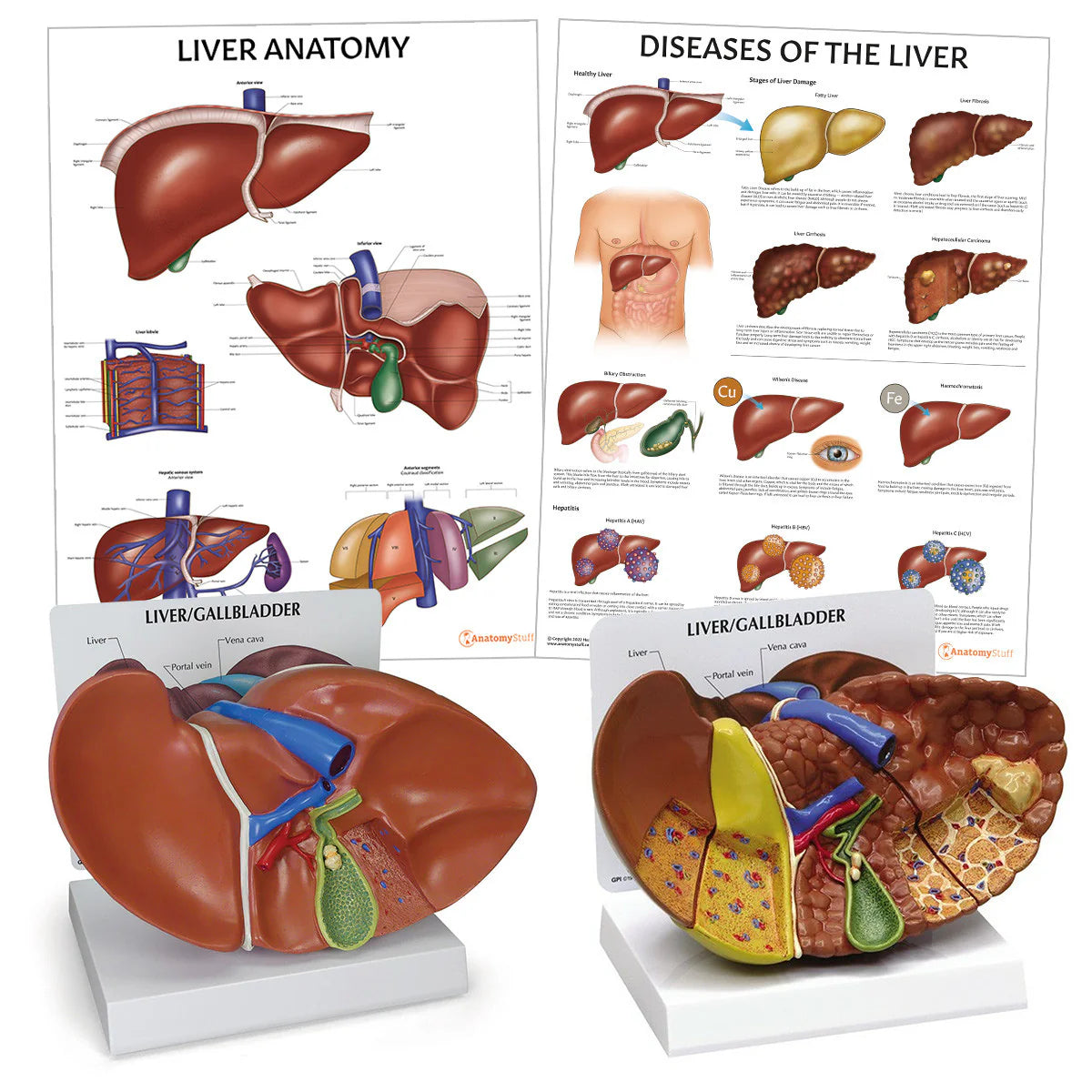 Liver Anatomy & Pathology Collection - 