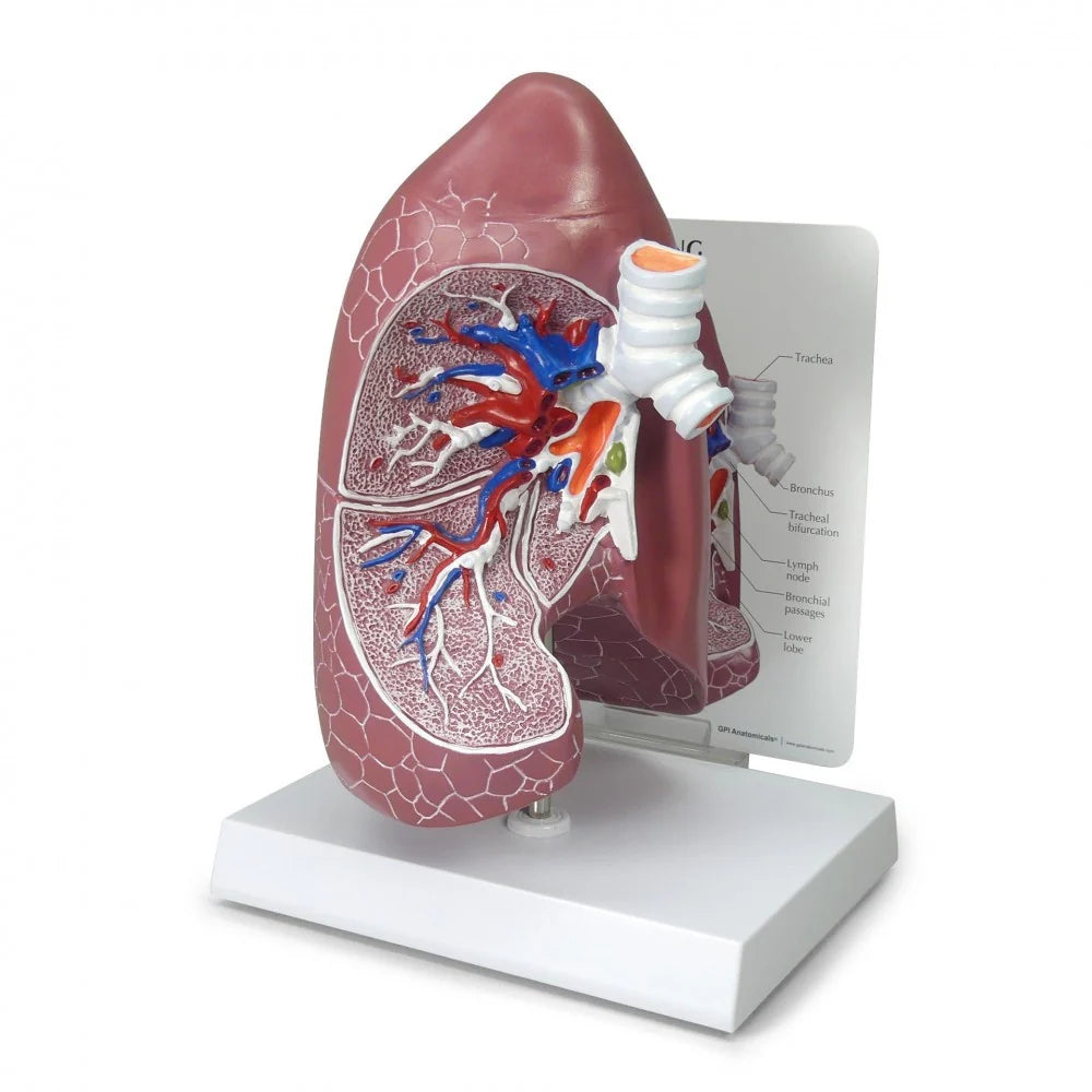 Lung Anatomy & Pathology Collection - 