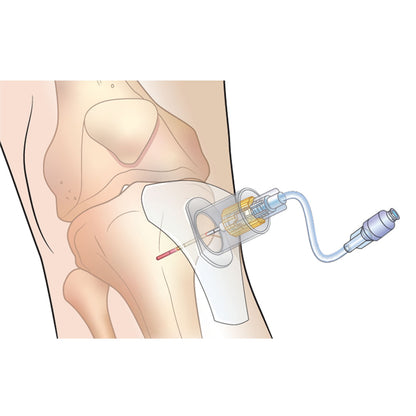 SAM IO® Stabiliser - 