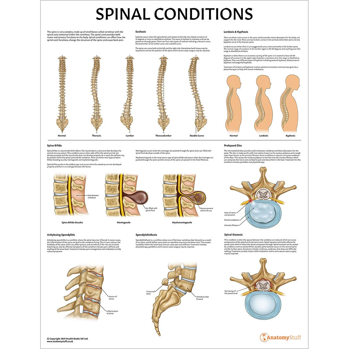 Spine Anatomy & Pathology Collection – Medisave UK