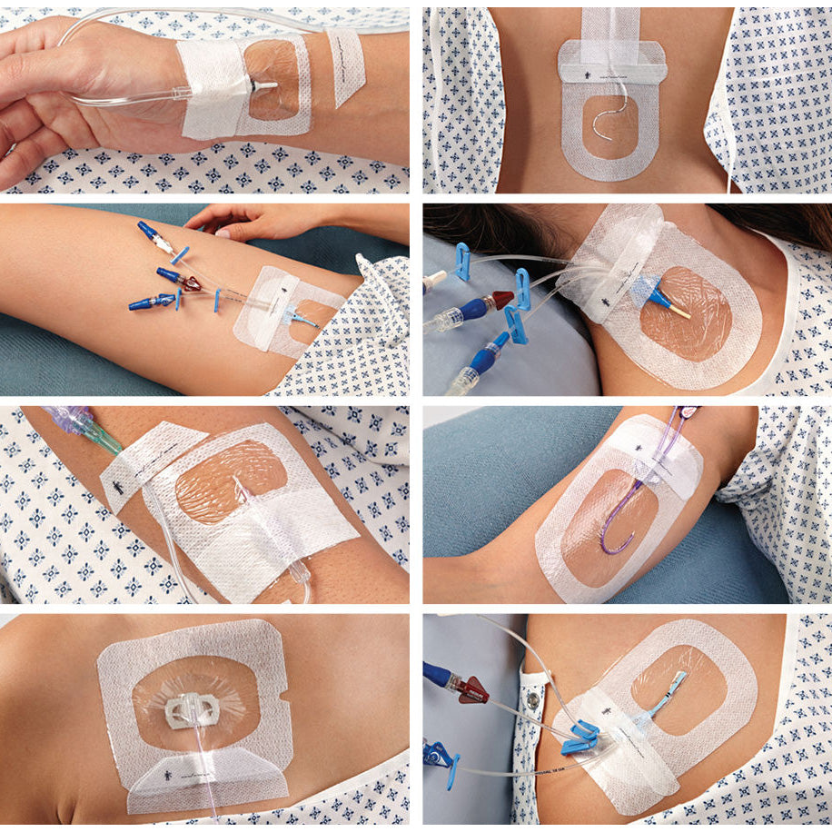 Iv Dressing Types 3M Tegaderm IV Dressings – Medisave UK