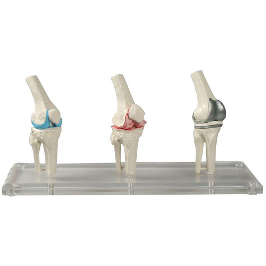 Knee Joint Model