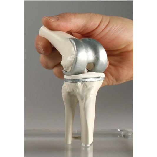 Knee Joint Model