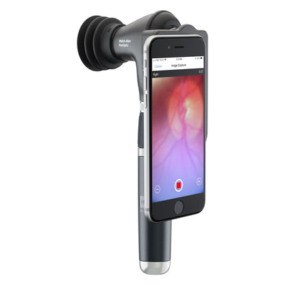 Welch Allyn PanOptic Plus Ophthalmoscope 3.5v [iExaminer - Head only] - Welch Allyn