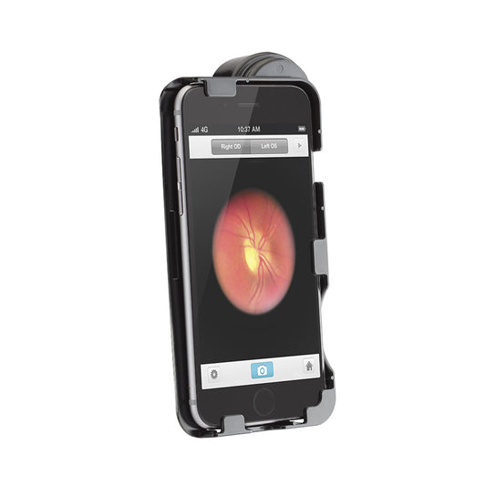Welch Allyn iExaminor Adaptor for the iPhone 6 Plus & 6S Plus - Welch Allyn