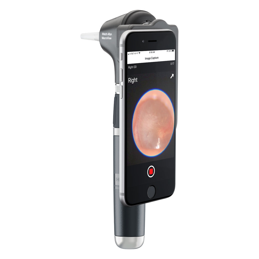 Welch Allyn MacroView Plus Otoscope 3.5v [iExaminer - Head only] - Welch Allyn