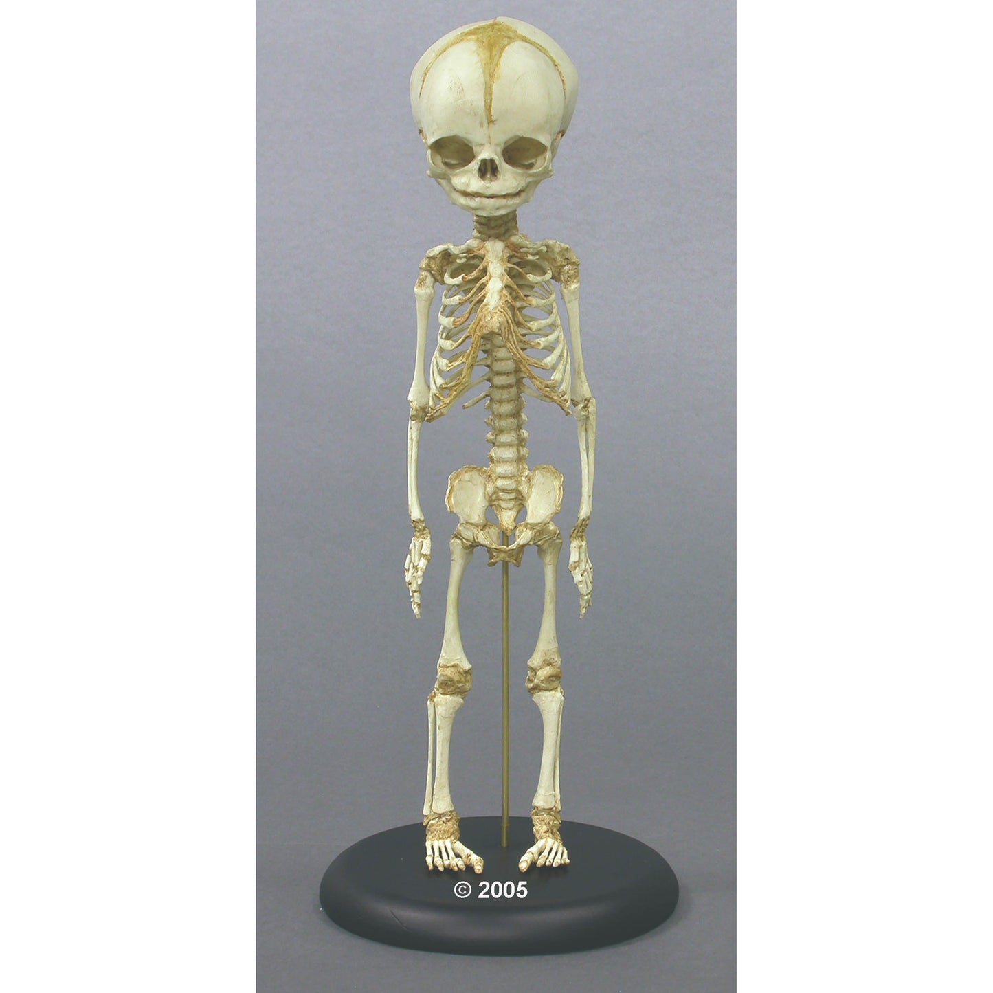 Foetus Skeleton - 30. Week