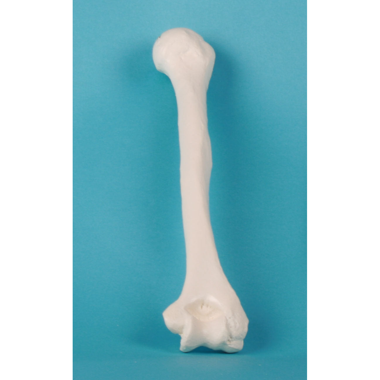 Single Humerus Humerus (Upper Arm) – Medisave UK