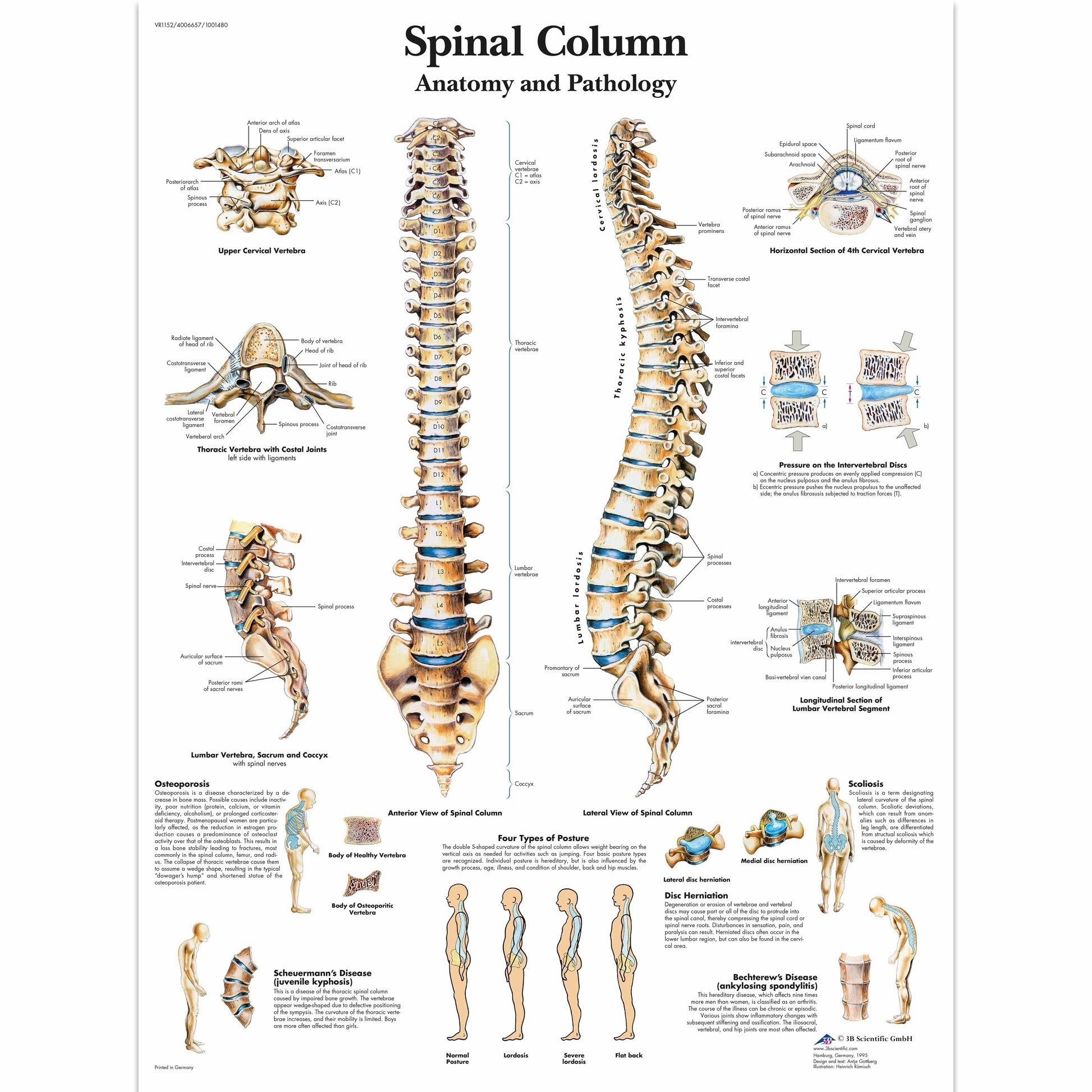 Spinal Column Chart - 3B Scientific