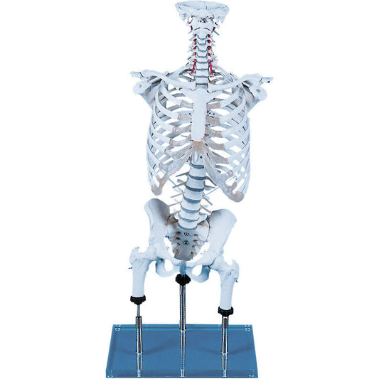 Vertebral Column for Demonstration of Malpositions (acc. to Zilgrei)
