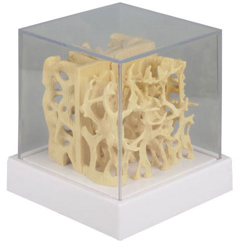 Healthy / Osteoporotic Bone Structure Comparison Model - 