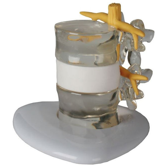 Erler Zimmer Herniated Disc Simulator