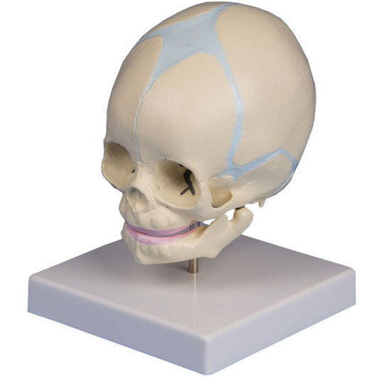 Foetal Skull - 30 Week