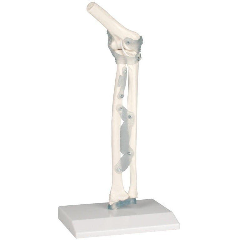 Elbow Joint with Ligaments and Stand