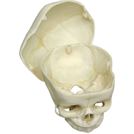 Foetal Skull with Calvarium Cut - 40 Weeks